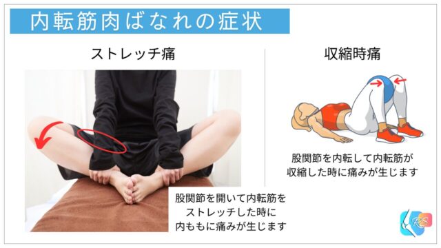 内転筋　肉ばなれ　症状　ストレッチ痛　収縮時痛　